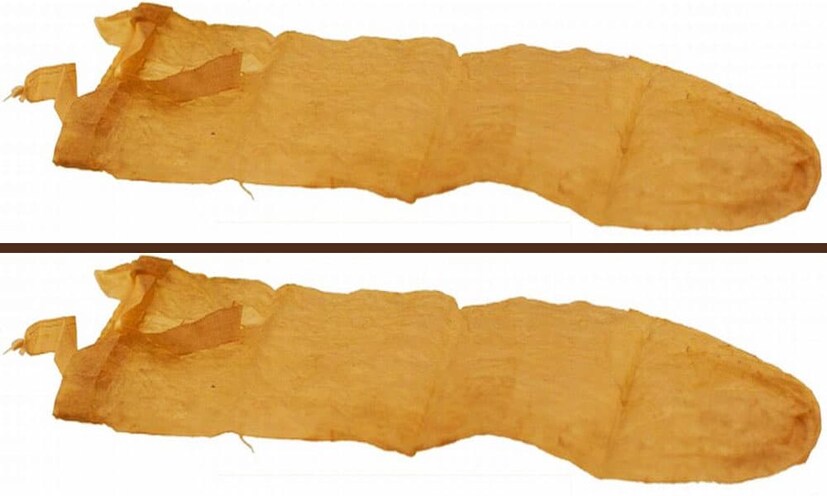 ষষ্ঠদশ শতকে ইউরোপ জুড়ে যৌন রোগ সিফিলিস দেখা যায়। ইতালির চিকিৎসক গ্যাব্রিয়েলি ফ্যালোপিয়ো একটি বিশেষ রাসায়নিকে সিক্ত করা লিনেন আবরণ বানান পেনিসের জন্য। এই আবরণ সঙ্গমের সময় পেনিসে জড়িয়ে ফিতে দিয়ে বেঁধে দেওয়া হত। এটিই প্রথম কন্ডোম যা এসটিডি বা যৌনরোগ নিরোধক।