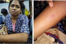 কামড় বিতর্ক! নড়েচড়ে বসল কলকাতা পুলিশ, তদন্তের নির্দেশ কামড় বিতর্ক! নড়েচড়ে বসল কলকাতা পুলিশ, তদন্তের নির্দেশ