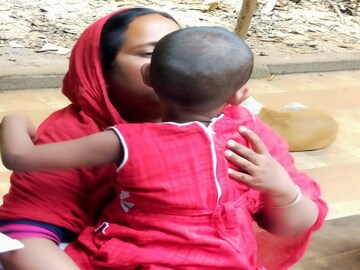 Child with brain tumour admitted to Calcutta medical college