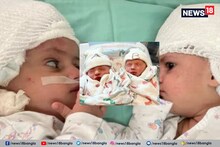 যমজ সন্তান অথচ জন্মসাল আলাদা, অবিশ্বাস্য এই ঘটনায় তাজ্জব বনে গেল গোটা বিশ্ব