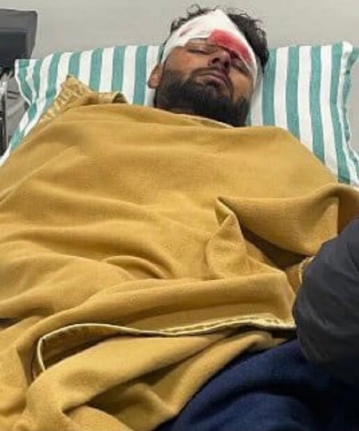ACL হল একটি লিগামেন্ট যা উরুর হাড়কে শিনবোনের সাথে সংযুক্ত করে এবং হাঁটু জয়েন্টকে স্থিতিশীল করতে সাহায্য করে। MCL উপরের শিনের হাড়ের পৃষ্ঠ থেকে নীচের উরুর হাড় পর্যন্ত চলে। অস্ত্রোপচার থেকে সেরে উঠতে পন্তের কমপক্ষে ৪ মাস এবং ম্যাচ ফিটনেস ফিরে পেতে আরও দুই মাস সময় লাগবে। অর্থাৎ ৬ মাসের আগে মাঠে ফিরতে পারবেন না তিনি।