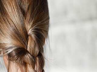Dry Hair Problem- Photo - Representative 