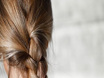 Dry Hair Problem- Photo - Representative 