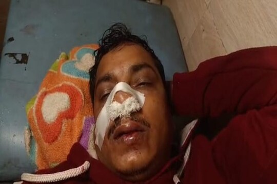 আহত অবস্থায় ভর্তি হাসপাতালে