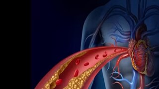 এই নিয়ম মানলে ঝটপট কমবে কোলেস্টেরল! সুস্থ থাকতে মানুন এই টিপস