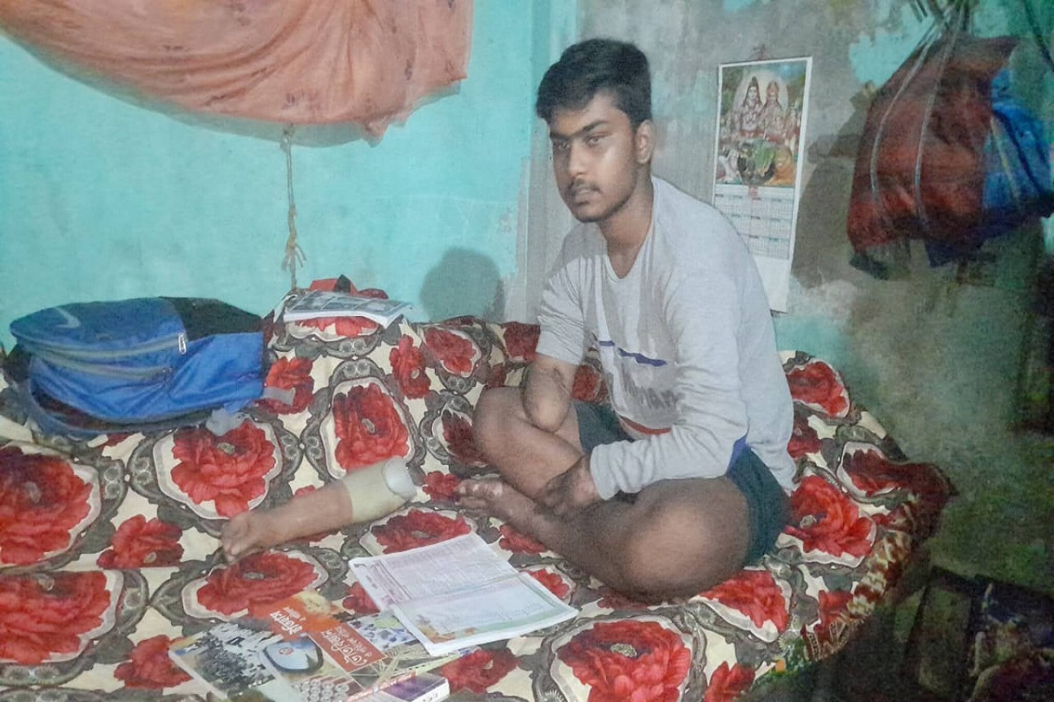 দুর্ঘটনায় নেই ২ হাত, মনের জোরেই মাধ্যমিক জয় বিশ্বজিতের