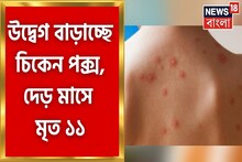 বাড়ছে চিকেন পক্সের দাপট, বছরের শুরুতেই চিকেন পক্সে ১২ জনের মৃত্যু