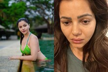 সার্জারি ছাড়াই চেহারার এ কী দুর্দশা! অসুস্থতার কথা জানিয়ে ভেঙে পড়লেন রুবিনা