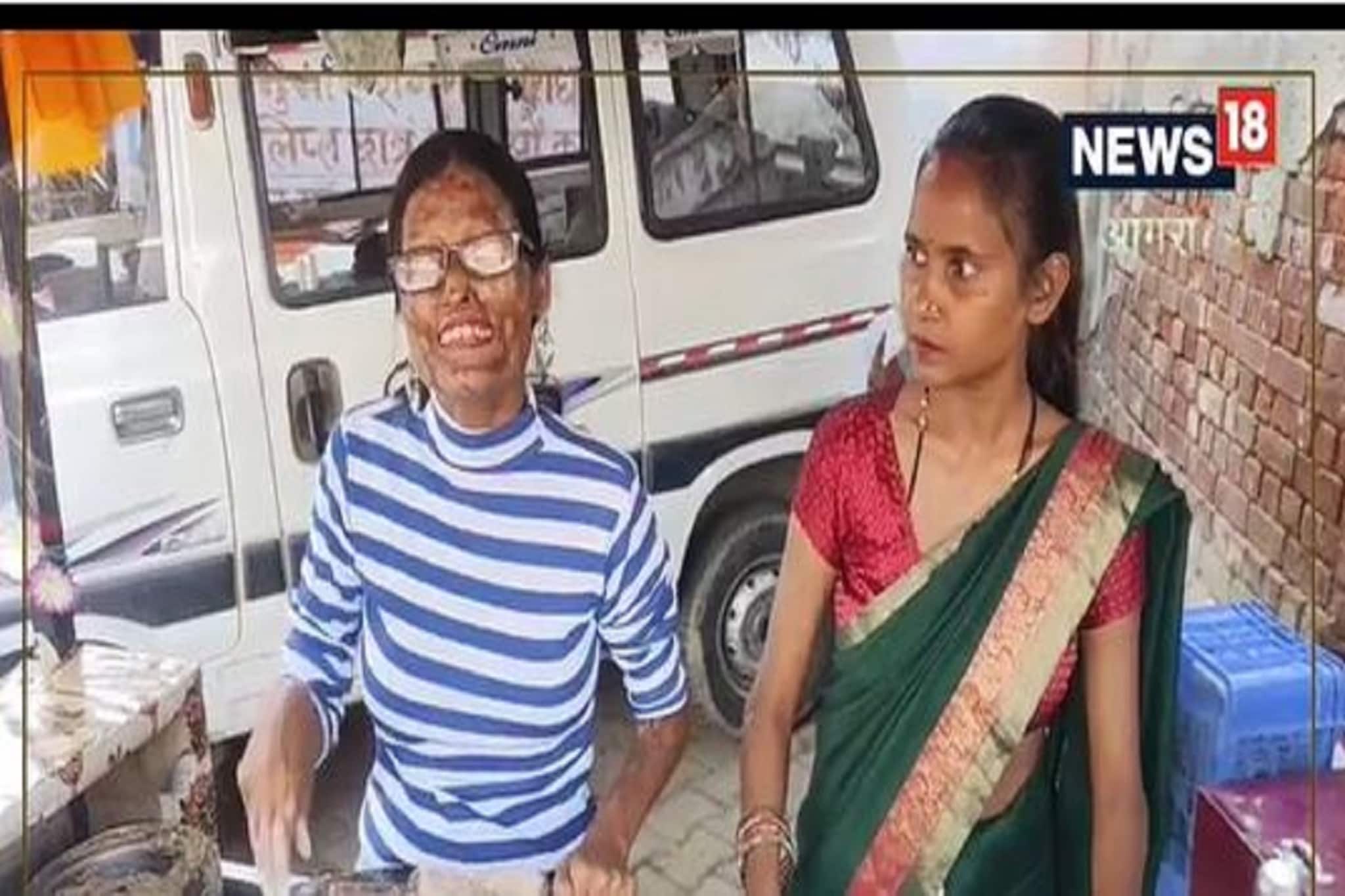 তিন বছর বয়সে অ্যাসিড ছুড়েছিল বাবা! প্রাণে বেঁচে কীভাবে ঘুরে দাঁড়ালেন নিতু?