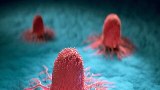 ক্যানসার প্রতিরোধ করা সম্ভব! তবে ভারতে এই রোগে মৃত্যুর হার বেশি কেন? ক্যানসার প্রতিরোধ করা সম্ভব! তবে ভারতে এই রোগে মৃত্যুর হার বেশি কেন?