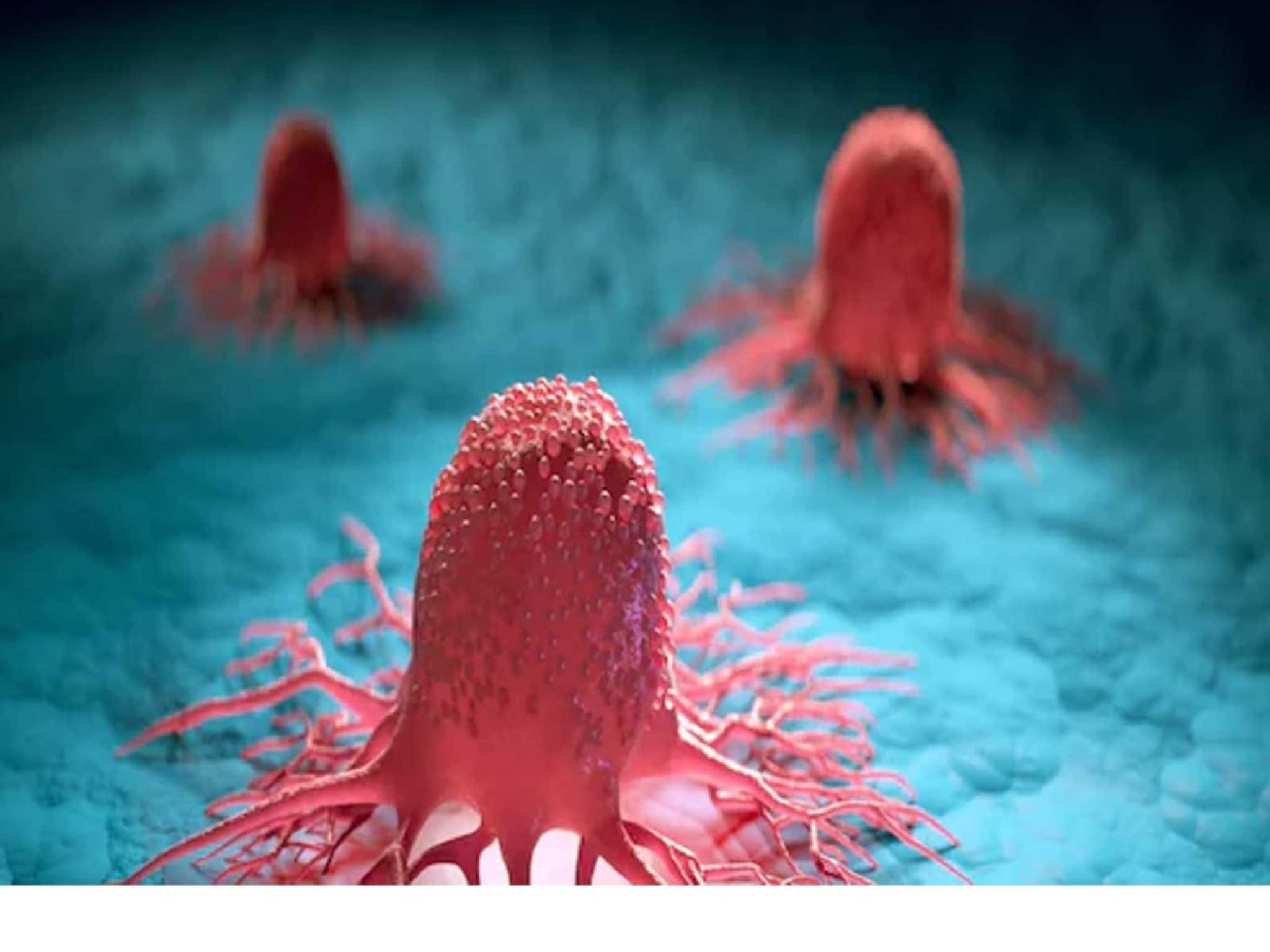 Cancer: ক্যানসার প্রতিরোধ করা সম্ভব! তবে ভারতে এই রোগে মৃত্যুর হার বেশি কেন? কী বলছেন বিশেষজ্ঞ