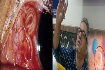 মালদহে