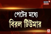 পেটে বিরল টিউমার, এনআরএসে জটিল অস্ত্রোপচারে সুস্থ নদিয়ার সাফিয়া শেখ