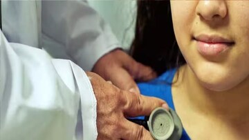 অ্যাডিনো