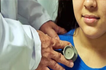 অ্যাডিনো