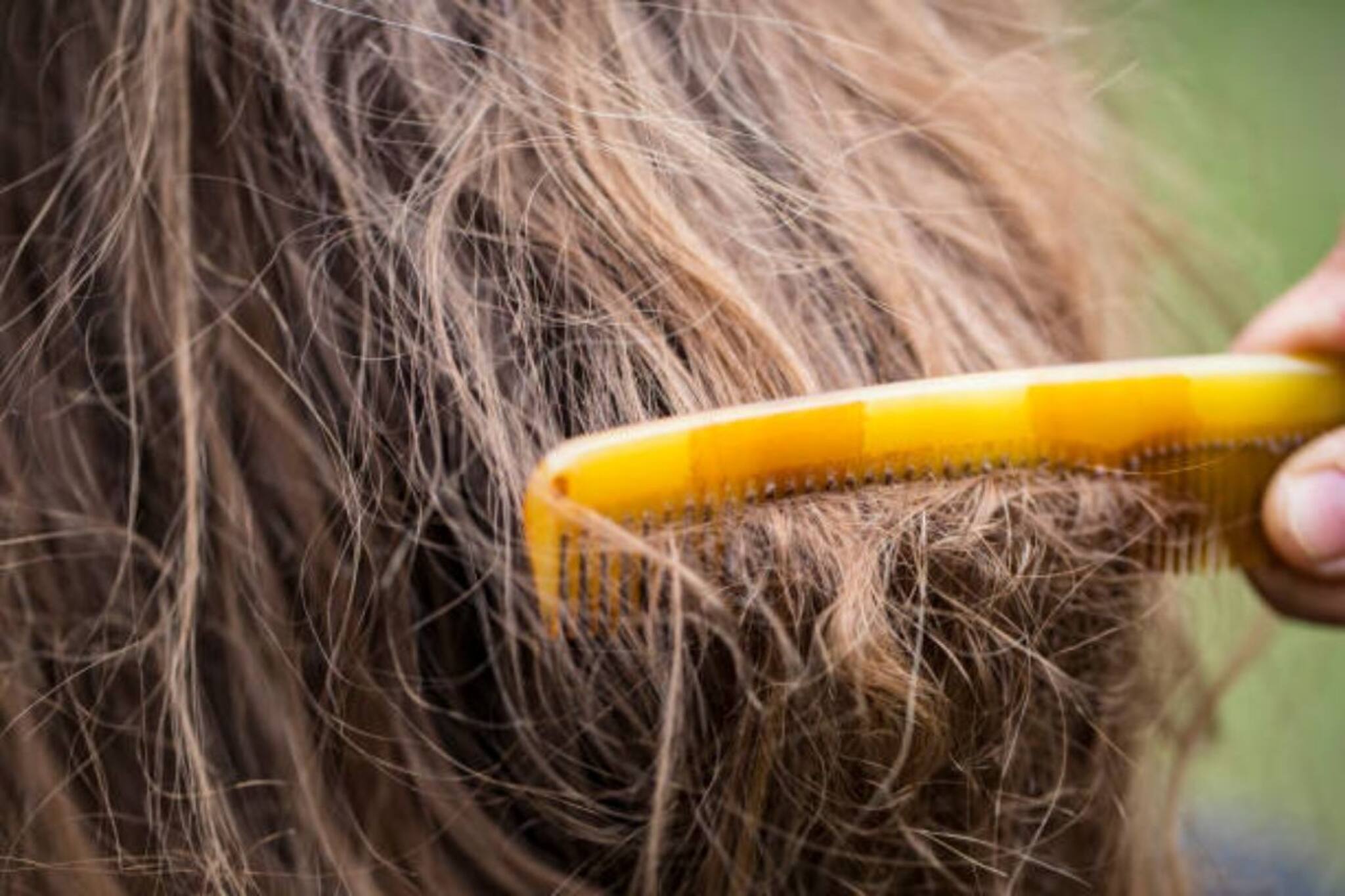 ভবঘুরেদের চুল পড়ে না কেন..? তেল লাগায় না, শ্যাম্পুও করে না! তবু মাথাভর্তি চুল!