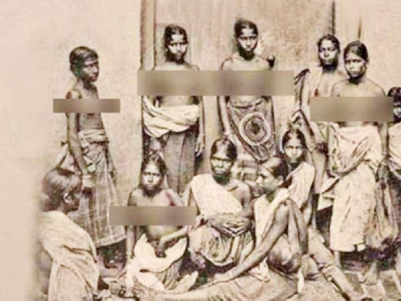 স্তন কর- ScoopWhoop ওয়েবসাইটের একটি প্রতিবেদন অনুসারে বলা যায়, ১৯ শতকের কেরলের ত্রাভাঙ্কুরে, নিম্নবর্ণের মহিলাদের তাদের স্তন ঢেকে রাখার জন্য স্তন কর দিতে হত। সেখানকার রাজা নারীদের স্তন ঢেকে থাকতে বাধ্য করেছিলেন। সেই সময় এই করের বিরুদ্ধে সরব হন নাখালি নামের এক মহিলা৷ নিজের একটি স্তন কেটে তিনি তুলে দেন রাজার হাতে। অতিরিক্ত রক্তরক্ষণে তিনি মারাও যান। তবে এই কাহিনির সত্যতা যাচাই করা যায় না। (ছবি: নিউজ 18)