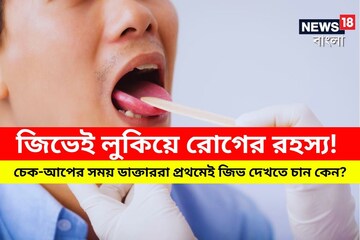 জিভেই লুকিয়ে রোগের রহস্য! চেক-আপের সময় ডাক্তাররা প্রথমেই জিভ দেখতে চান কেন? জিভেই লুকিয়ে রোগের রহস্য! চেক-আপের সময় ডাক্তাররা প্রথমেই জিভ দেখতে চান কেন?