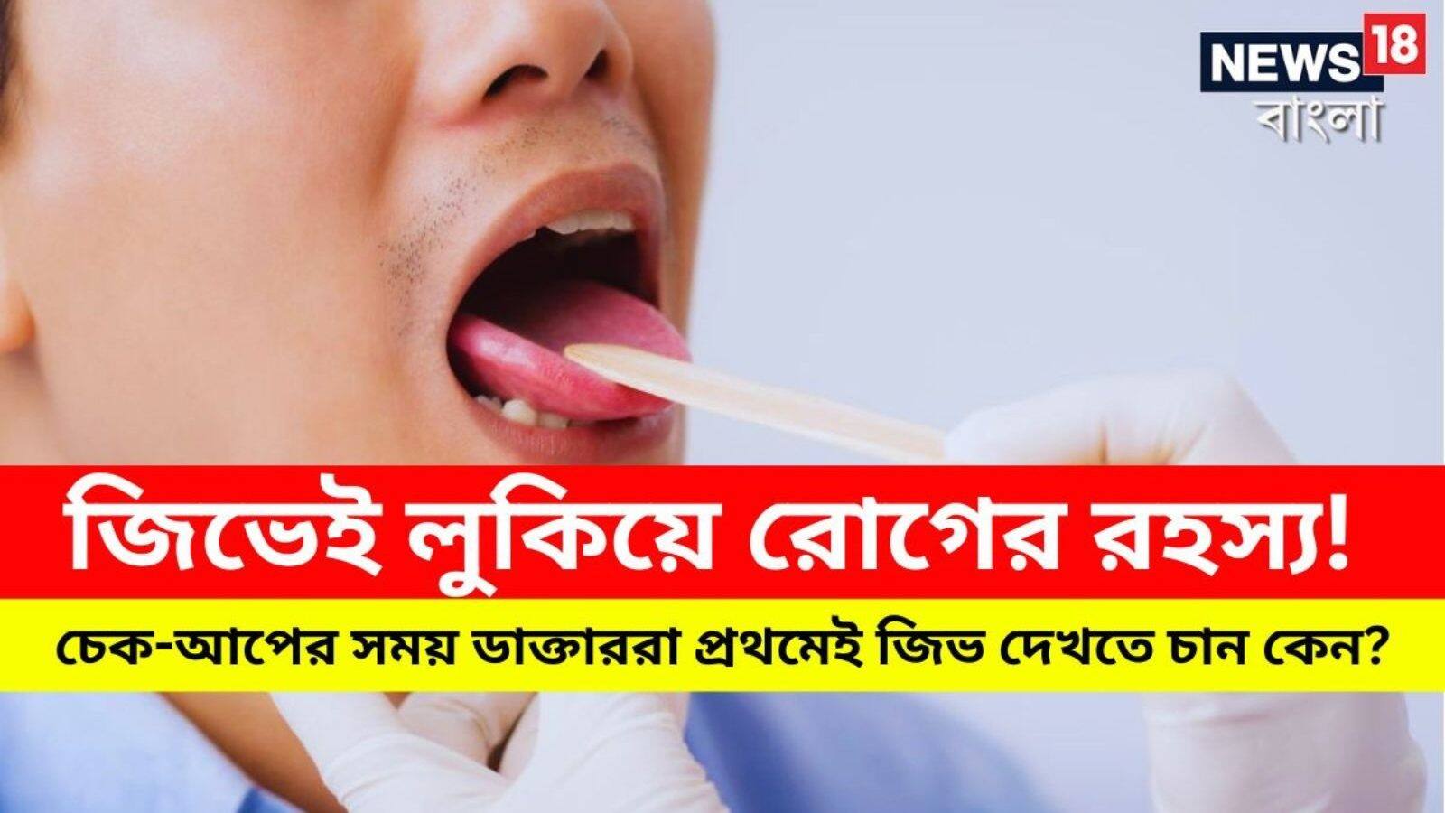 Doctors watch tongue first of Patients জিভেই লুকিয়ে রোগের রহস্য! চেক