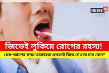 জিভেই লুকিয়ে রোগের রহস্য! চেক-আপের সময় ডাক্তাররা প্রথমেই জিভ দেখতে চান কেন?