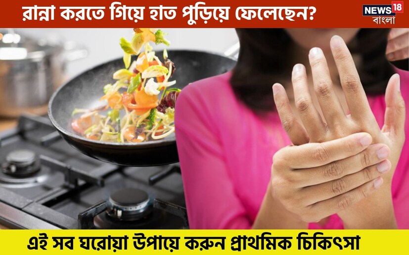 রান্না করতে গিয়ে অনেক সময় আচমকাই গরম কড়াই কিংবা গরম প্যানে ছ্যাঁকা লেগে যায়। এতে ত্বক পুড়ে যেতে পারে। আর গোটা ঘটনাটাই ঘটে যায় অসাবধানতাবশত! তবে ত্বকে অল্প ছ্যাঁকা লাগলেও তার জেরে যে কষ্টটা হয়, সেটা মারাত্মক! 
