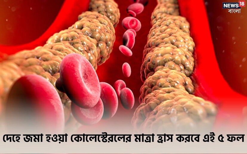 আমাদের শরীরে কোলেস্টেরল বাড়লে ঘনিয়ে আসে বিপদ। ফলে সব সময় তা নিয়ন্ত্রণে রাখা বাঞ্ছনীয়। এক জন মানুষের দেহে কোলেস্টেরলের স্বাভাবিক পরিমাণ হবে প্রতি ডেসিলিটারে ২০০ মিলিগ্রাম। তবে কোলেস্টেরল বাড়লে তার প্রাথমিক লক্ষণ সেভাবে প্রকাশ পায় না। ফলে অনেকেই কোলেস্টেরলকে নীরব ঘাতক বলে ডেকে থাকেন।