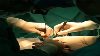 ‘চোখের আলো’ কর্মসূচি রূপায়ণে ঢিলেঢালা মনোভাব, ছানি অপারেশনের গতি বাড়ানোর জন্য আরও চিকিৎসক নিয়োগ রাজ্যে ‘চোখের আলো’ কর্মসূচি রূপায়ণে ঢিলেঢালা মনোভাব, ছানি অপারেশনের গতি বাড়ানোর জন্য আরও চিকিৎসক নিয়োগ রাজ্যে