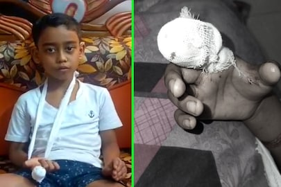 গুরুতর জখম ছাত্র