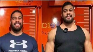 এমনিতেই ৬ ফুট লম্বা, সুপুরুষও, তাও কেন অপারেশন করে আরও ৭ ইঞ্চি উচ্চতা বাড়ালেন সানচেজ?