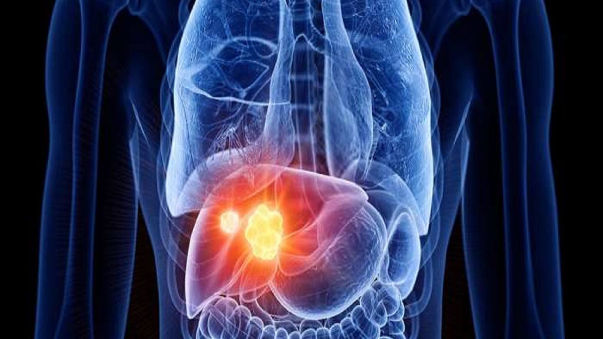 Liver Disease: ক্রমশ কী নষ্ট হচ্ছে আপনার লিভার? আজই বুঝে নিন 'এই' লক্ষণগুলি দেখে, বলছেন বিশেষজ্ঞ চিকিৎসক