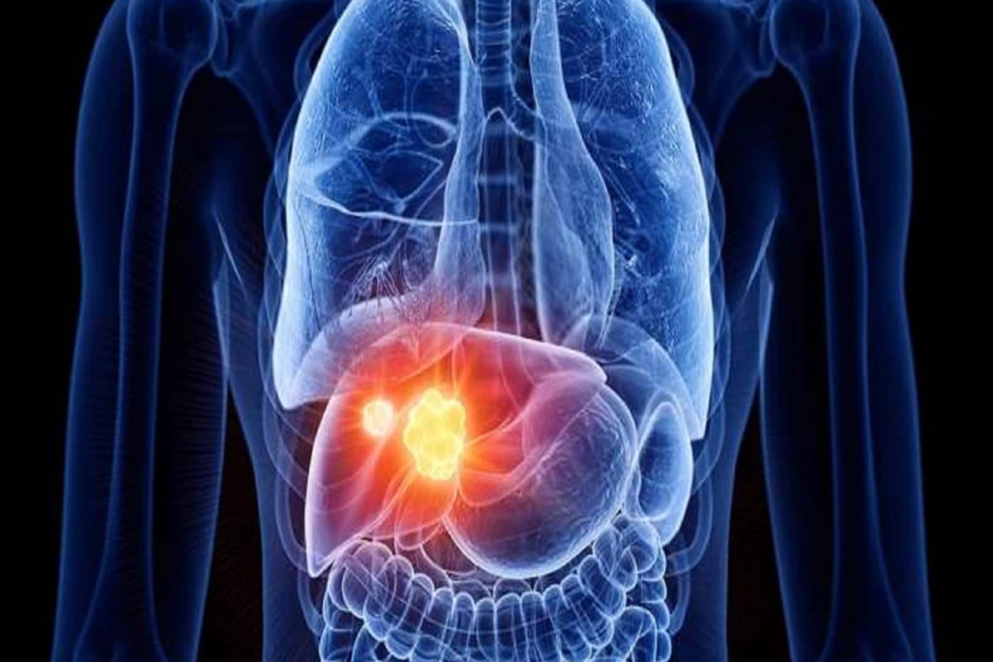 Liver Disease: ক্রমশ কী নষ্ট হচ্ছে আপনার লিভার? আজই বুঝে নিন 'এই' লক্ষণগুলি দেখে, বলছেন বিশেষজ্ঞ চিকিৎসক