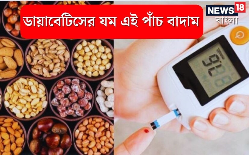 High Blood Sugar Control Tips: ডায়াবেটিস বা মধুমেহ এমনই একটি রোগ যা শরীরে বাসা বাঁধলে খাবার দাবারের দিকে বিশেষ ভাবে নজর দিতে হবে ৷ প্রতীকী ছবি ৷