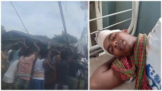 দুই রাজনৈতিক দলের চলছে মারামারি, আহত যুবক চিকিৎসাধীন হাসপাতালে দুই রাজনৈতিক দলের চলছে মারামারি, আহত যুবক চিকিৎসাধীন হাসপাতালে