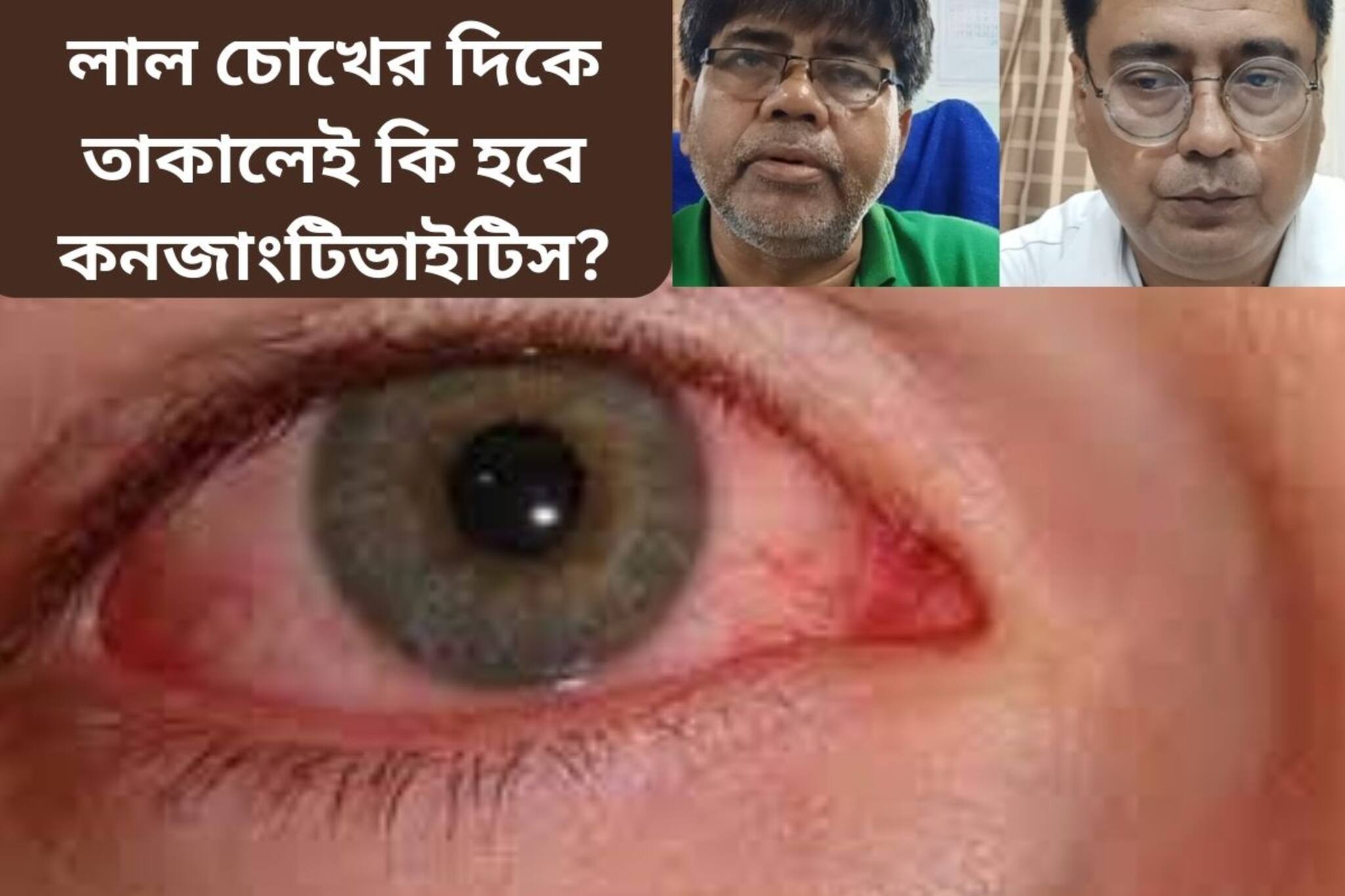 লাল চোখের দিকে তাকালেই কি হবে কনজাংটিভিটিস? কেন এত দ্রুত ছড়াচ্ছে? জানুন চিকিৎসক