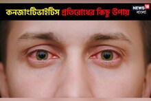 জবাফুলের মতো লাল চোখ নিয়ে ভিড় ডাক্তারখানায়; রইল কনজাংটিভাইটিস প্রতিরোধের উপায়