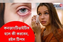 উত্তরোত্তর বাড়ছে ‘আই ফ্লু’-র সংক্রমণ; কী কী সতর্কতা অবলম্বন করা আবশ্যক?