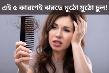 এই ৫ কারণেই ঝরছে মুঠো মুঠো চুল! জেনে নিন মুক্তির উপায়