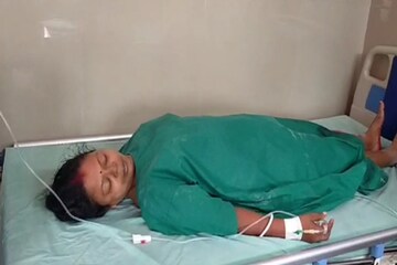 অপারেশনের