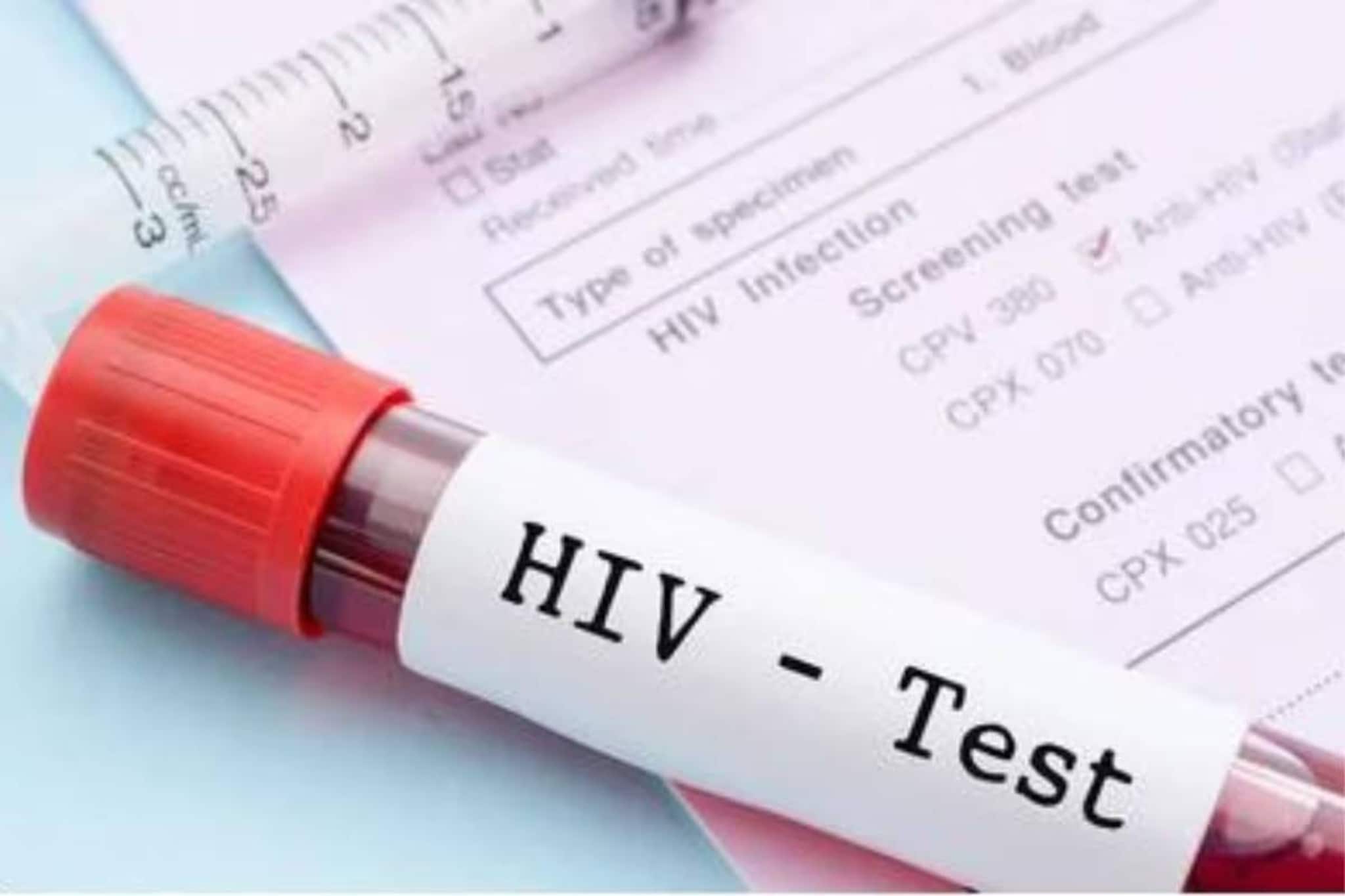HIV Aids: এইচআইভি পজিটিভ মানেই কি জীবন শেষ? কী বলছেন বিশেষজ্ঞ চিকিৎসক, জেনে নিন