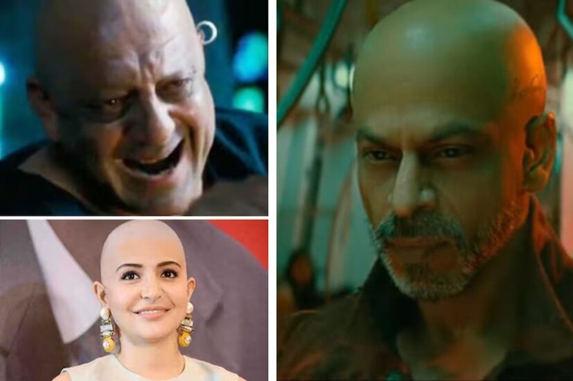 শাহরুখ খানের ছবি 'জওয়ান'-এর ট্রেলার আসার পর থেকেই ছবিতে তাঁর নতুন লুক হয়ে উঠেছে আলোচনার বিষয়। 'জওয়ান'-এ প্রথমবার পর্দায় চুল ছাড়া দেখা যাচ্ছে শাহরুখ খানকে। কিন্তু শাহরুখই  কী প্রথম যিনি চরিত্রে খাতিরে ন্যাড়া হয়ে পর্দায় এলেন? না, তাঁর আগেও অনেক অভিনেতা-অভিনেত্রী চরিত্রের জন্য ন্যাড়া হয়েছেন। আবার অনেকে মেকআপের আশ্রয় নিয়েছিলেন। রইল এমনই ৫ অভিনেতা- অভিনেত্রীর নাম।