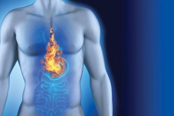 বুক জ্বালা, হজমের সমস্যা? ৬টি সেরা খাবার যা অ্যাসিড রিফ্লাক্স কমাতে সাহায্য করে!