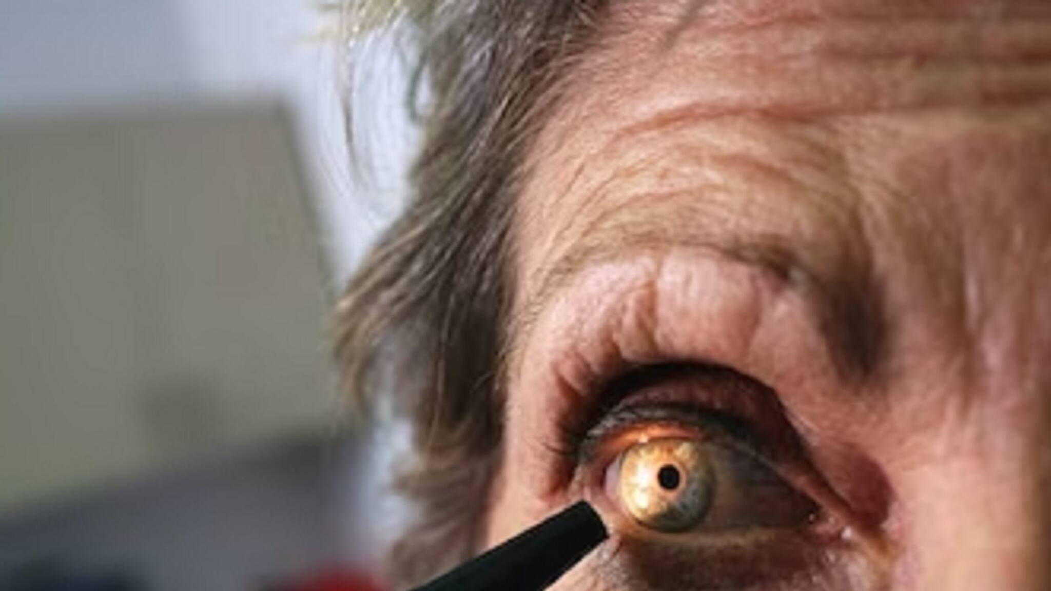 Cataract Surgery: চোখের জন্য সঠিক লেন্স বাছবেন রোগী না চিকিৎসক? জেনে নিন আসল সত্য