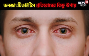 জবাফুলের মতো লাল চোখ নিয়ে ভিড় ডাক্তারখানায়; রইল কনজাংটিভাইটিস প্রতিরোধের উপায় জবাফুলের মতো লাল চোখ নিয়ে ভিড় ডাক্তারখানায়; রইল কনজাংটিভাইটিস প্রতিরোধের উপায়