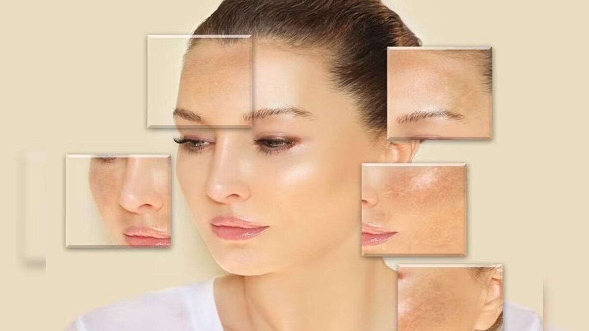 skin-pigmentation-skin-scars-dark-spot-how-to-remove-skin-scar-how