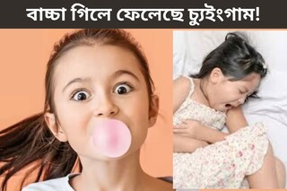 বাচ্চা গিলে ফেলেছে চ্যুইংগাম! কোন সর্বনাশ হতে পারে? কী করা উচিত? জেনে নিন ডাক্তারের পরামর্শ