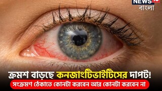 ক্রমশ বাড়ছে কনজাংটিভাইটিসের দাপট! সংক্রমণ ঠেকাতে কোনটা করবেন আর কোনটা করবেন না; পরামর্শ বিশেষজ্ঞের ক্রমশ বাড়ছে কনজাংটিভাইটিসের দাপট! সংক্রমণ ঠেকাতে কোনটা করবেন আর কোনটা করবেন না; পরামর্শ বিশেষজ্ঞের