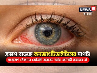 ক্রমশ বাড়ছে কনজাংটিভাইটিসের দাপট! সংক্রমণ ঠেকাতে কোনটা করবেন আর কোনটা করবেন না; পরামর্শ বিশেষজ্ঞের