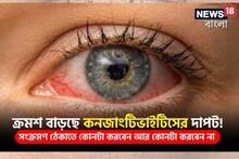 ক্রমশ বাড়ছে কনজাংটিভাইটিসের দাপট! সংক্রমণ ঠেকাতে কোনটা করবেন আর কোনটা করবেন না