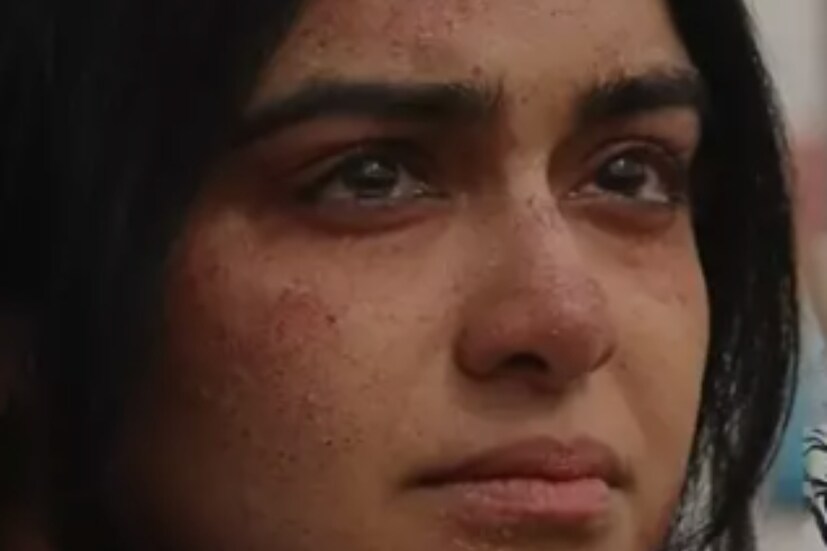 এতদিন ফুল হাতা পোশাক পরে প্রচার চালাচ্ছিলেন নায়িকা৷ তবে অ্যালার্জি যেভাবে বেড়ে যাচ্ছে তাতে আর নয় বলে জানিয়েছেন নায়িকা৷  অভিনেত্রী জানিয়েছেন, ওষুধের কারণে এই অ্যালার্জির প্রকোপ আরও বেড়ে গিয়েছে৷