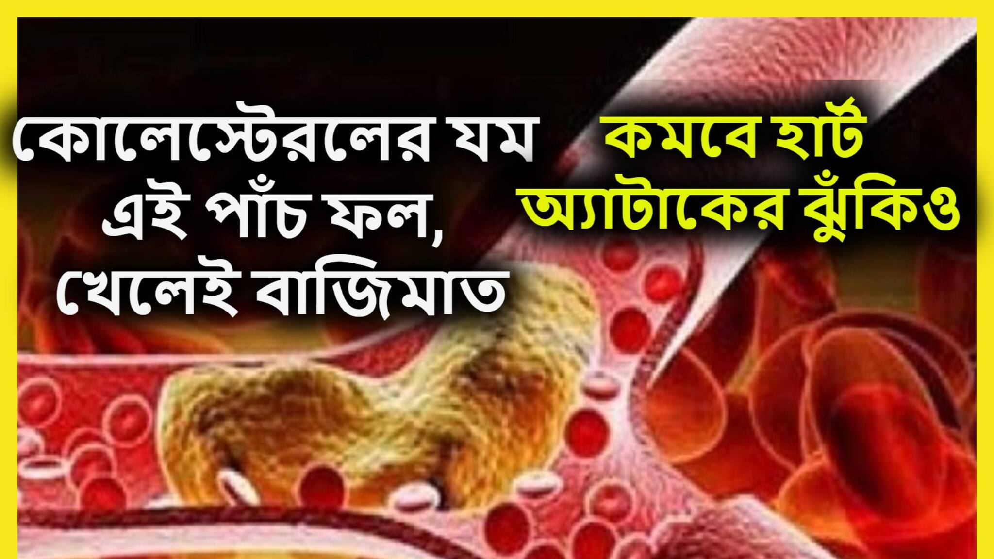 High Cholesterol Control Tips: এই ৫ ফলই কোলেস্টরলের যম! প্রতিদিন খেলেই বাজিমাত, শরীর সুস্থ, কমবে হার্ট অ্যাটাকের ঝুঁকি
